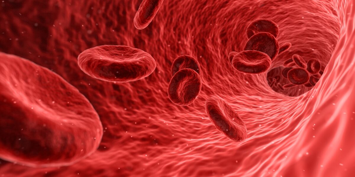 Arterie pulite